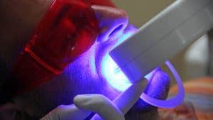 How much does it cost to have your teeth whitened?